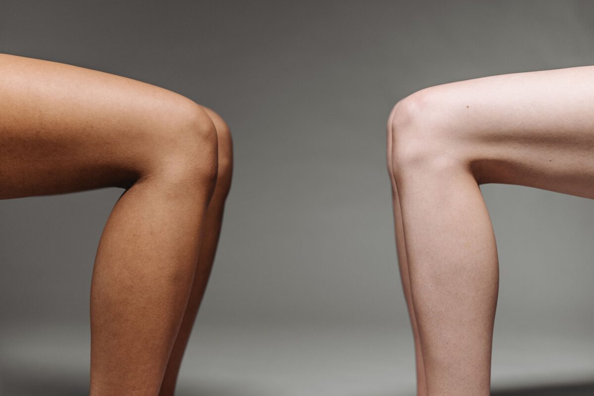 Will Your Knees Last a Lifetime? The Science-Backed Protection Guide